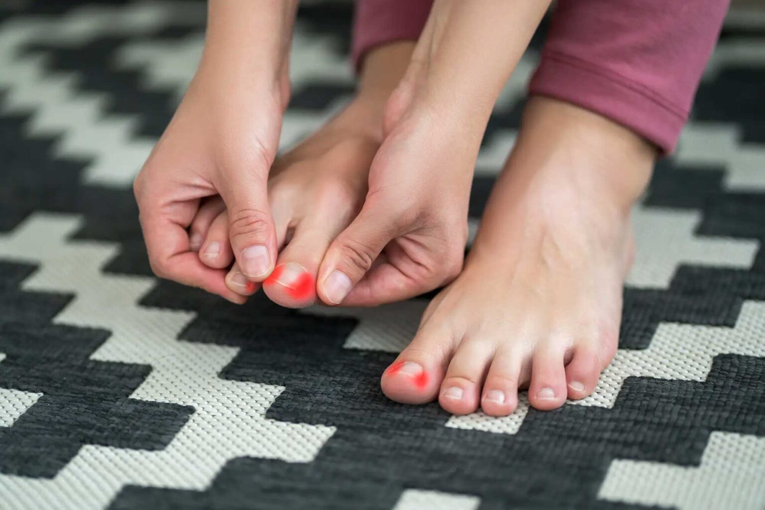 Houston Podiatrist Tips for Preventing Ingrown Toenails
