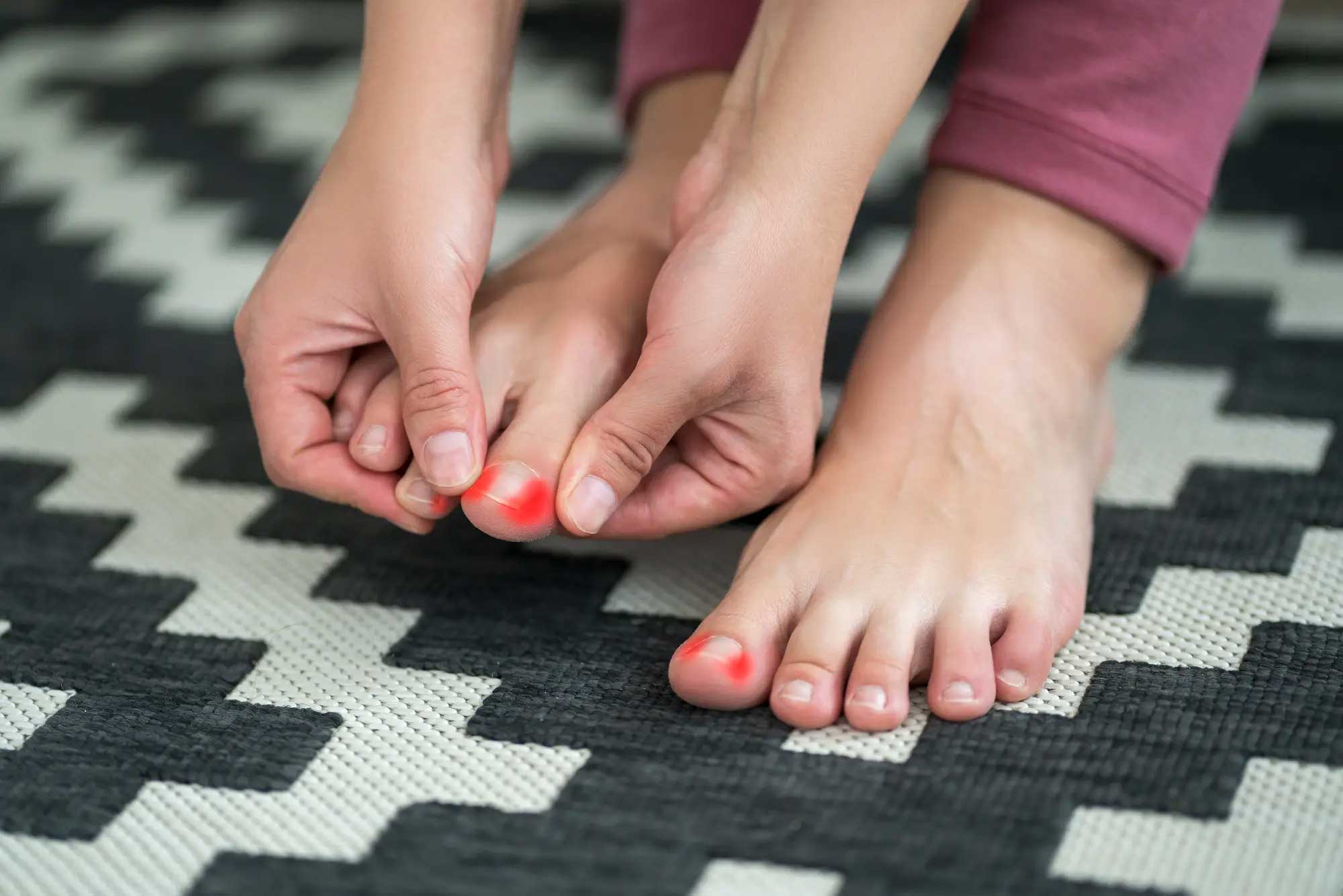 Houston Podiatrist Tips for Preventing Ingrown Toenails