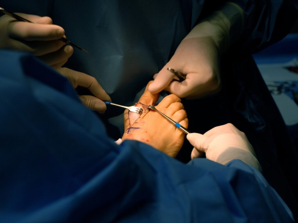 A bunion surgery doctor doing surgery for a patient in Silverglen North
