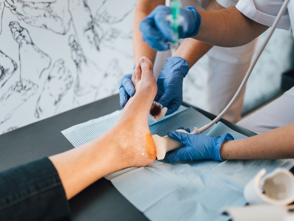 A diabetic foot wound specialist treating the foot of a diabetic patient in Belmont Place.
