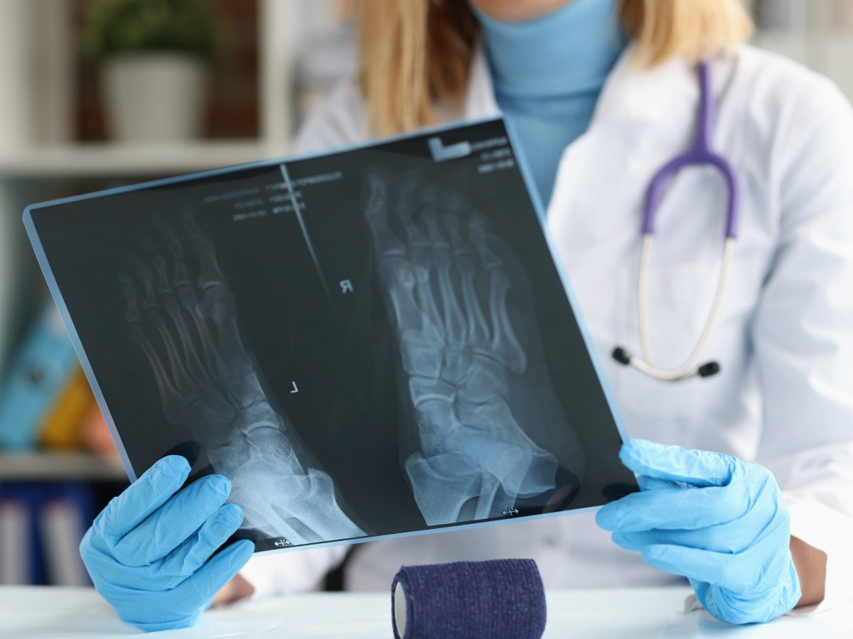 A foot doctor reviewing the X-ray results of a patient's foot in Silverglen Estates.