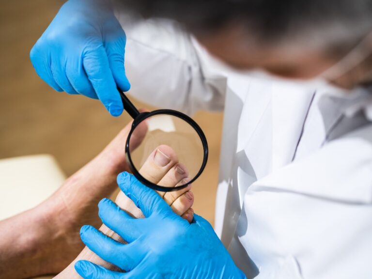 A podiatrist examining an ingrown toenail.
