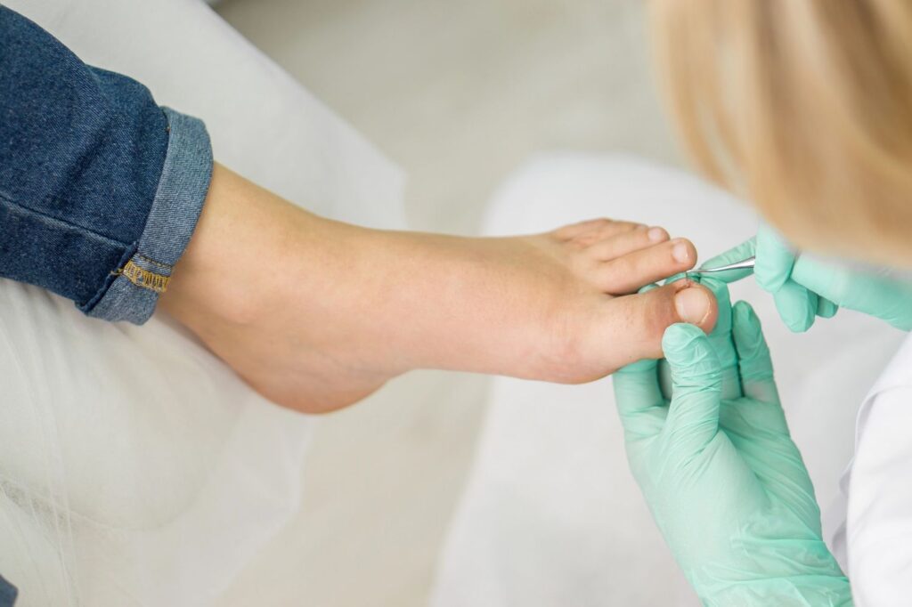 Podiatrist ingrown toenail procedure with precision nail cleaning in clean, professional grooming environment.