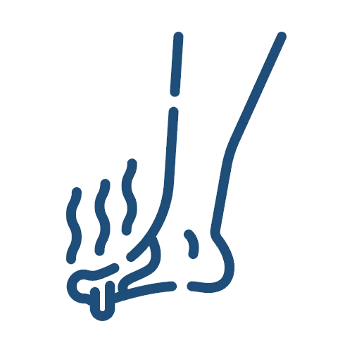 Foot infection treatment in Cypress Tx
