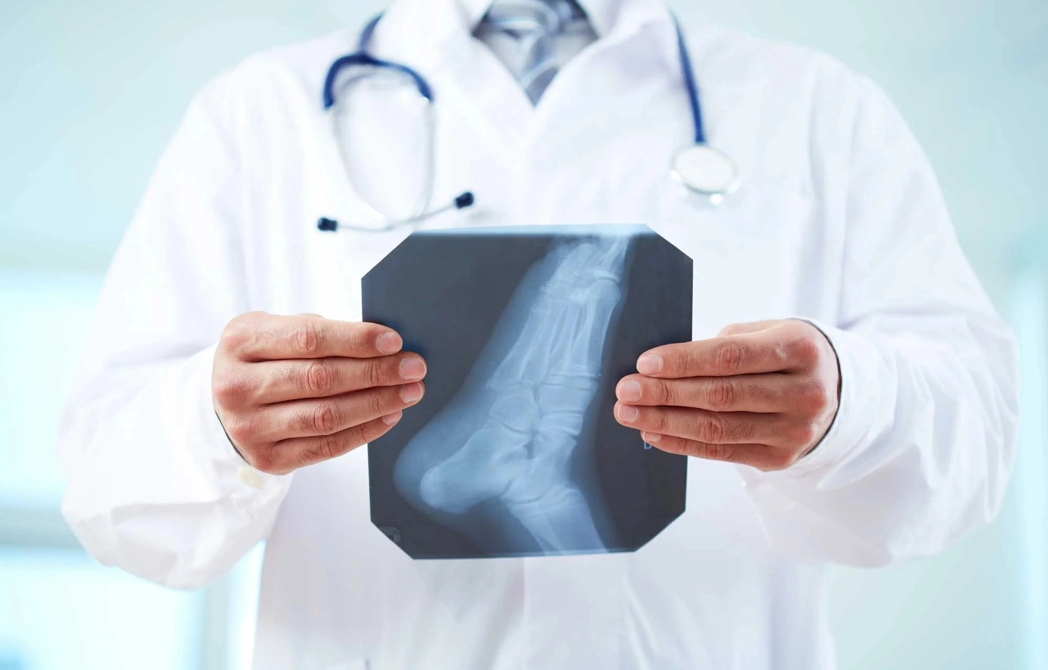 Foot specialist in Cypress Tx showing an x-ray of a patient's foot