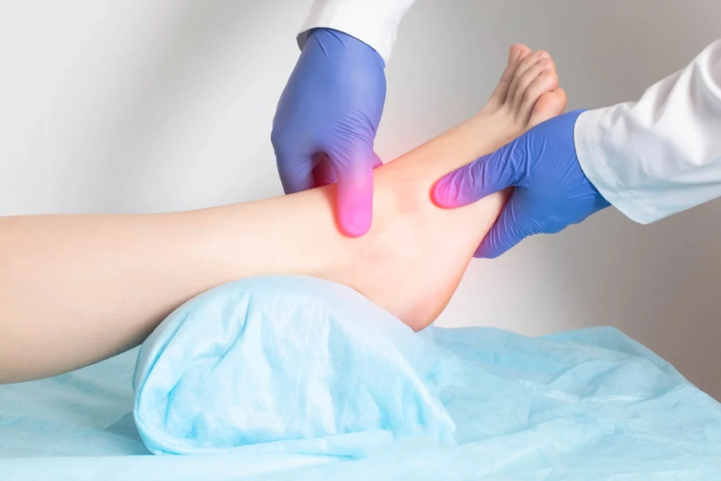 Foot doctor Houston examines inflamed ankle to assess Achilles tendon pain and provide targeted treatment options.