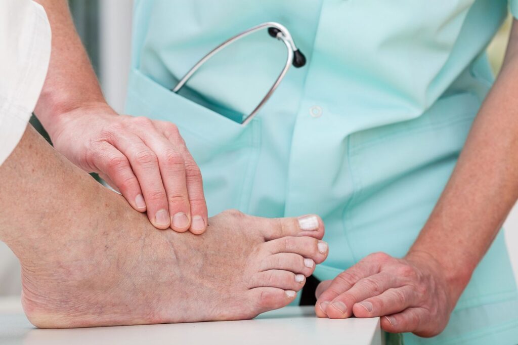 Foot doctor walk in Houston clinic provides expert bunion exams and personalized care for foot pain and joint issues.