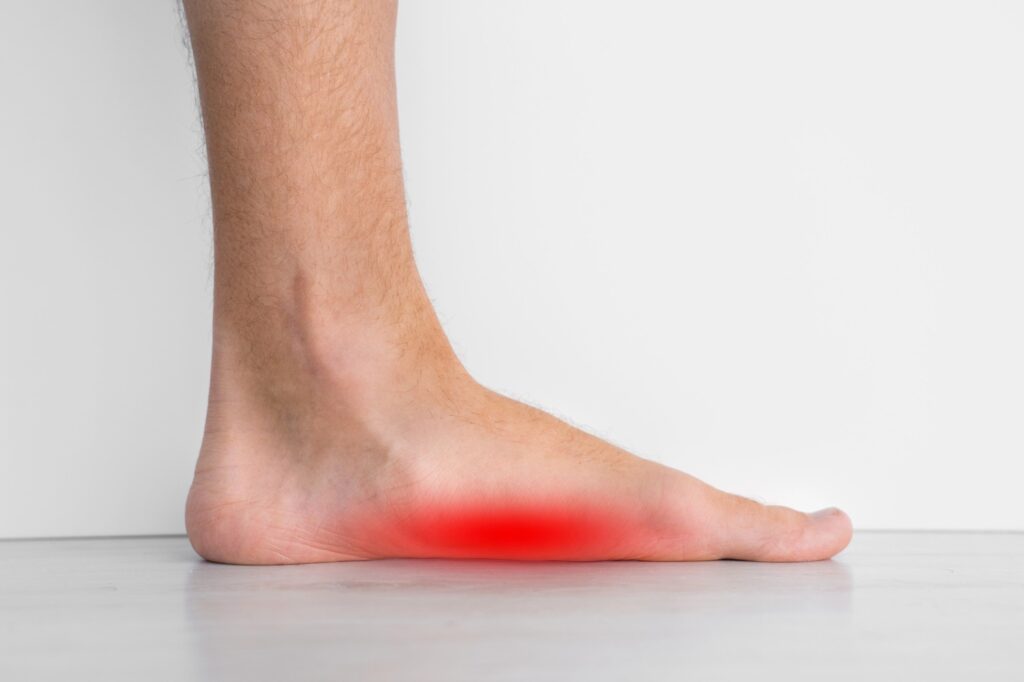 Foot doctor walk in Houston treats arch pain and flatfoot conditions with expert evaluation and custom care plans.