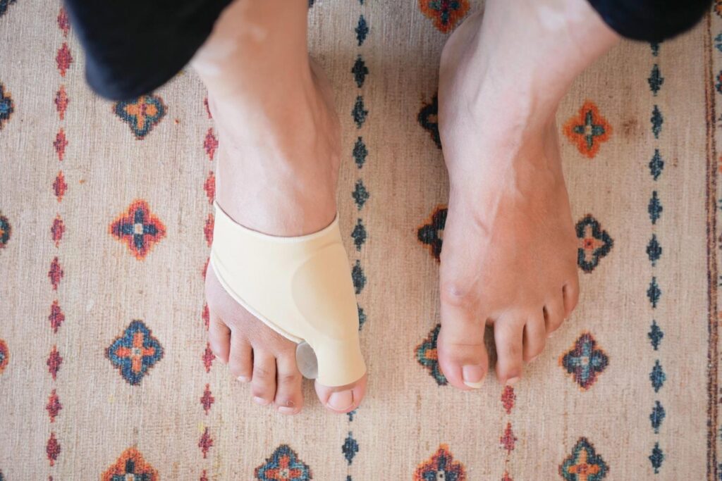 Bunion surgery doctors recommend toe separators to relieve pressure and align big toe before or after treatment.