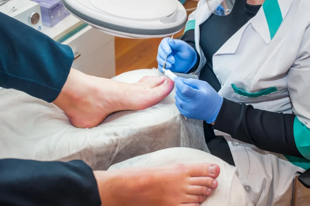 Podiatrist Ingrown Toenail Cypress performs toenail treatment in clean clinic. Technician applies polish under lamp.