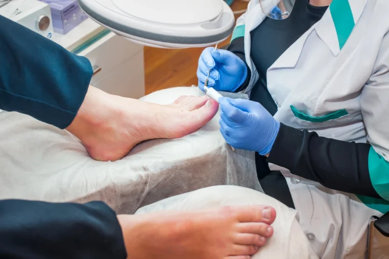 Podiatrist Ingrown Toenail Cypress performs toenail treatment in clean clinic. Technician applies polish under lamp.