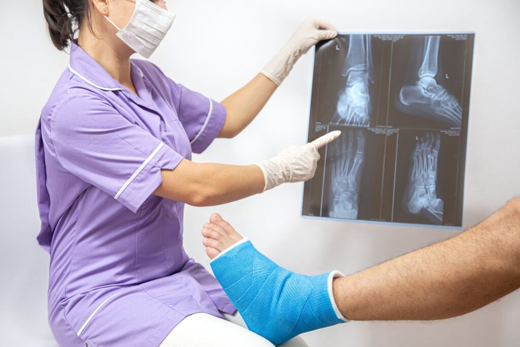 Nurse showing X-ray to patient with a casted ankle, services by a Foot and Ankle Doctor Houston.