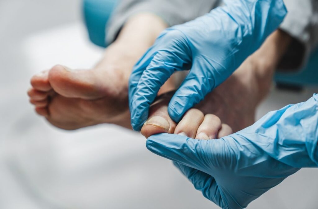 Close-up of foot doctor walk in exam inspecting toenails for infection or ingrown nail treatment in clinical setting.