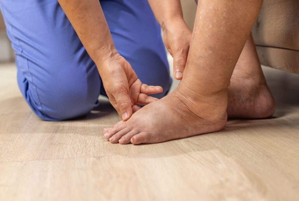 Medical expert assessing swollen foot for Diabetic Foot Care Treatment Cypress on clinic’s hardwood floor