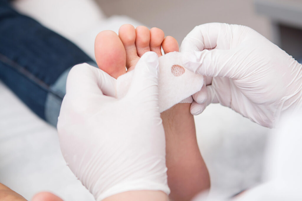 Medical professional applying bandage near toes for wound care, gentle treatment — Foot And Ankle Specialist