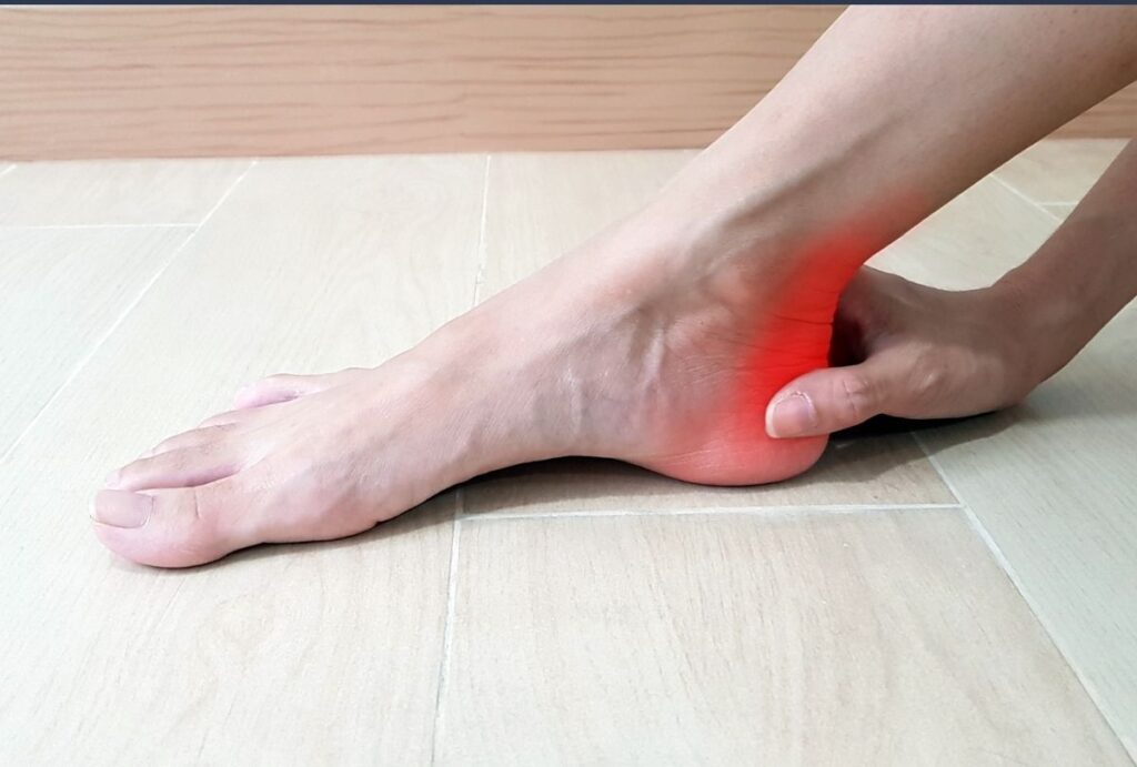 Red heel pain shown in close-up as Wharton’s Jelly Podiatrist Houston provides care for plantar fasciitis symptoms.