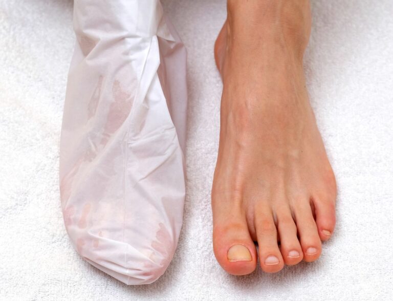Patient foot resting during a session of QUTENZA treatment Houston doctors prescribe for lasting nerve pain relief.