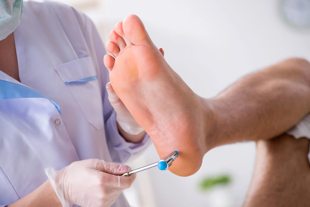 Plantar reflex test with hammer on patient’s foot, gloved provider assessing nerve function at a podiatry clinic.