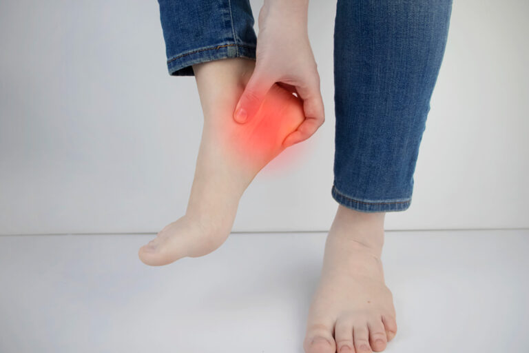 Red heel and ankle inflammation suggesting gout or plantar fasciitis strain; Heel Pain Houston clinic evaluation and care.