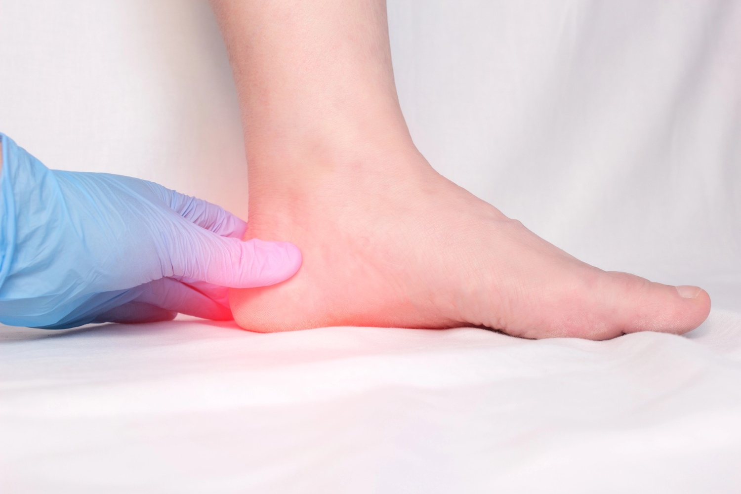 Foot with heel pain needing treatment