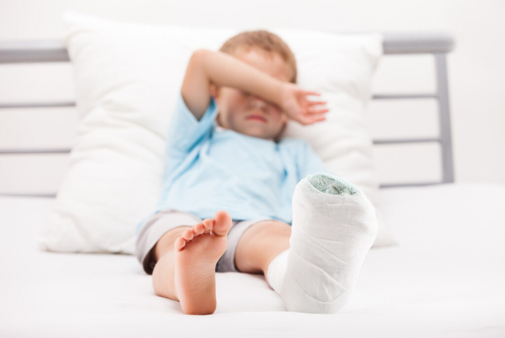 Pediatric patient in a cast recovering from a broken bone, managed by a Foot and Ankle Doctor Cypress specialist.