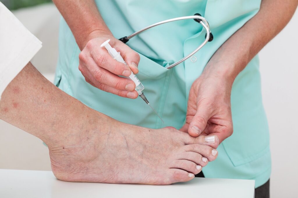 Professional bunion treatment doctors Cypress performing a precision cortisone injection for foot pain relief.