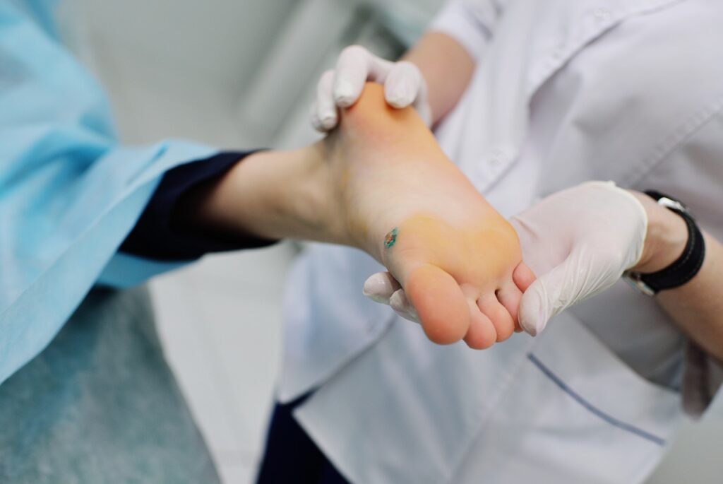 Professional Amerigroup podiatrist Cypress clinic providing advanced skin and wound care treatment for feet.