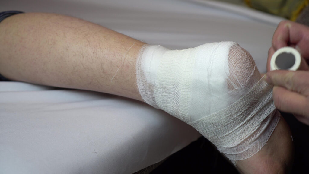 Hands applying a protective gauze wrap to a patient's heel for injury recovery at a trusted wound care clinic Houston.