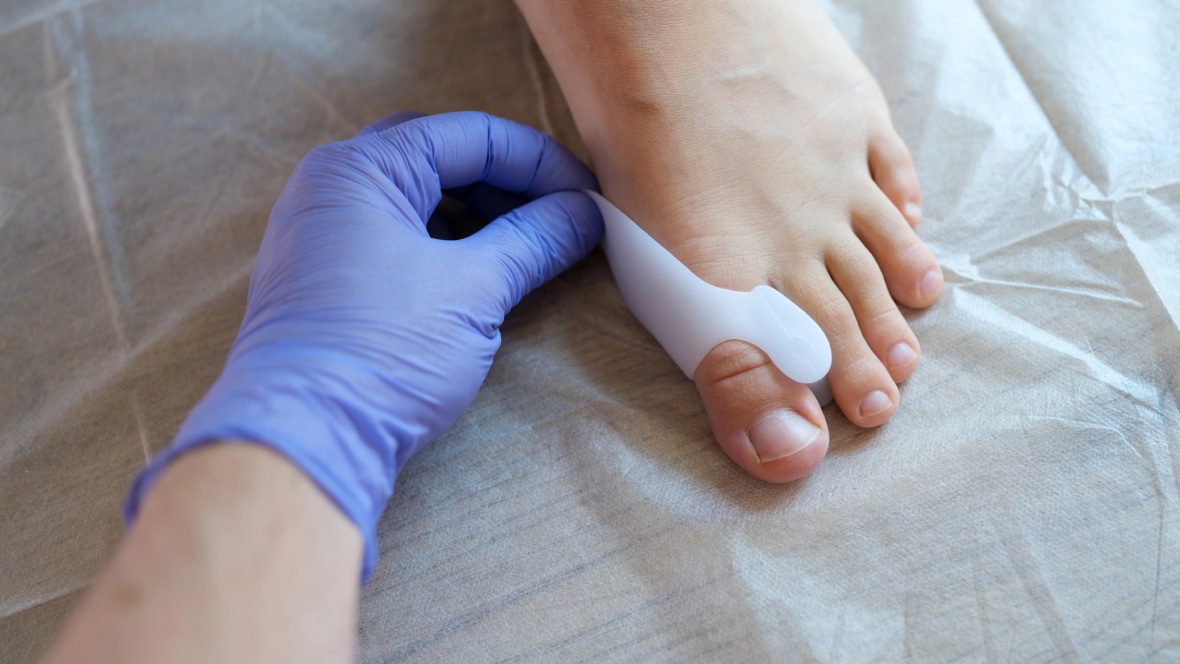 Toebro What Is a Toe Specialist and What Conditions Do They Treat? | Vital ...