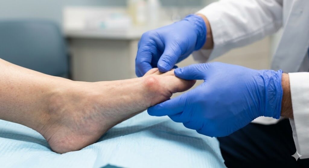 Close-up clinical photo of a DPM Houston diagnosing a patient's bunion deformity in a medical exam room.