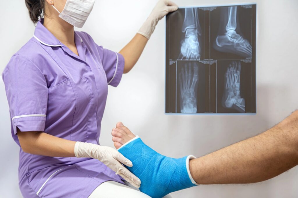 A professional foot specialist doctor examines a patient’s blue-casted foot while reviewing detailed ankle X-rays.