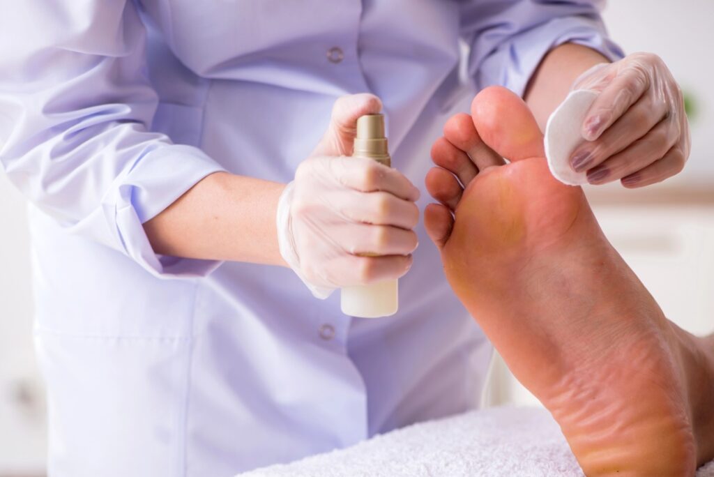 Expert toe doctors Cypress applying a medicated antifungal or antiseptic spray treatment to a patient's foot sole.
