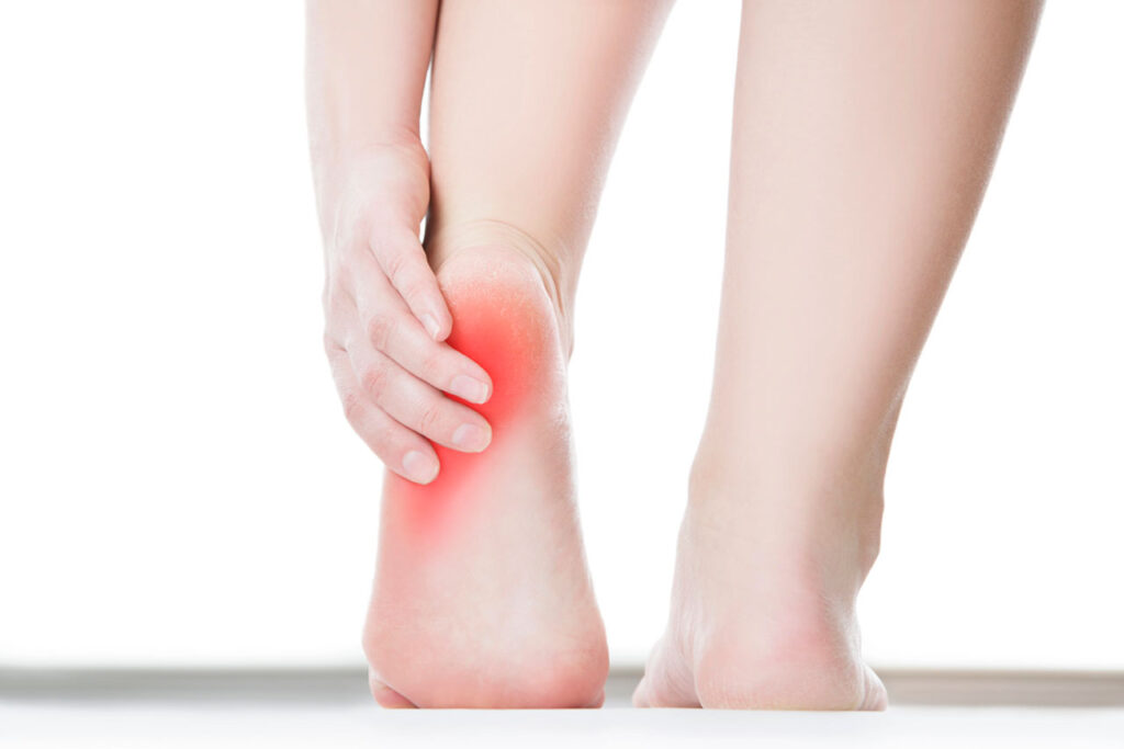 Close-up of a person gripping a painful, red heel, needing a local heel pain doctor Cypress for diagnosis.