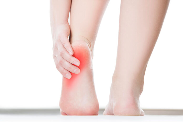Close-up of a person gripping a painful, red heel, needing a local heel pain doctor Cypress for diagnosis.