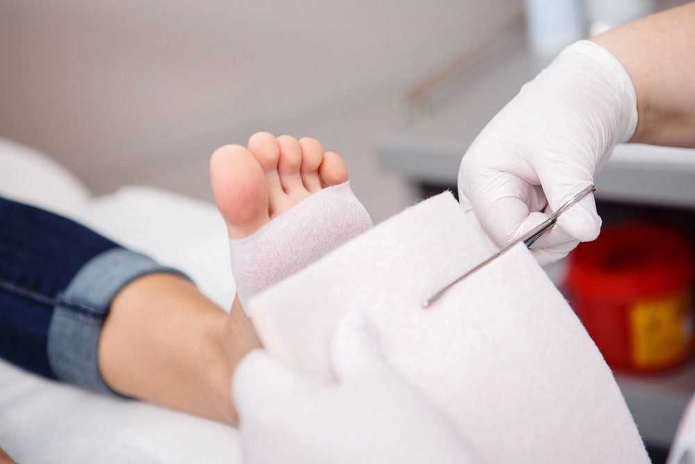 Gloved hands cutting medical gauze with scissors next to a bandaged foot at a Blue cross blue shield podiatrist cypress.